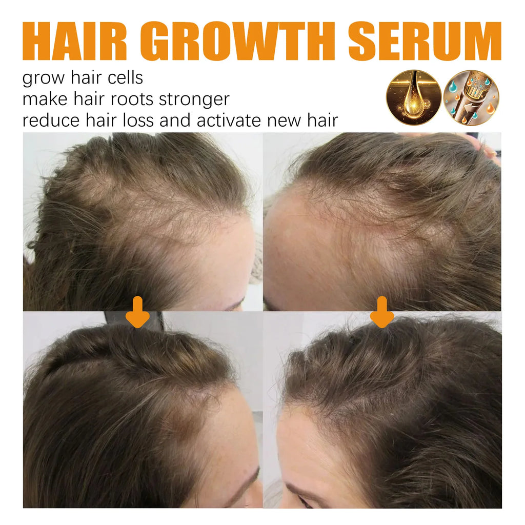 Keratin Silk Spray™ Spray de biotina para el cabello