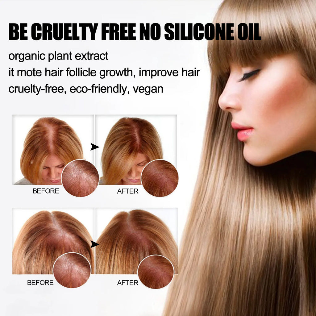Ginger Hair Growth Bar™ Champú crecimiento rápido
