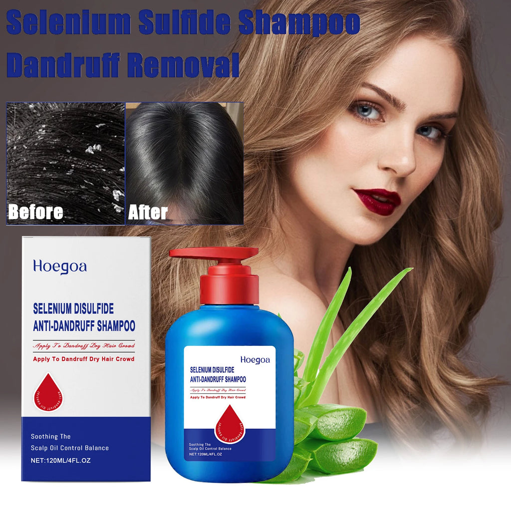 Scalp Relief™ Champú  calmante con sulfuro de selenio