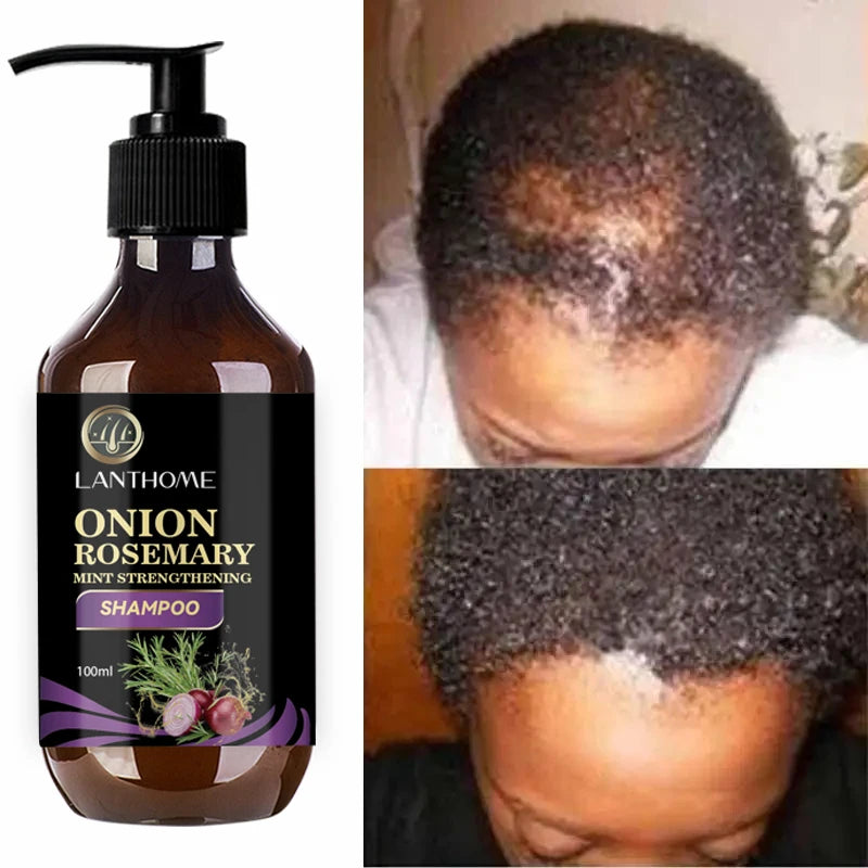 Onion Strengthening Treatment™ Champú para el crecimiento del cabello