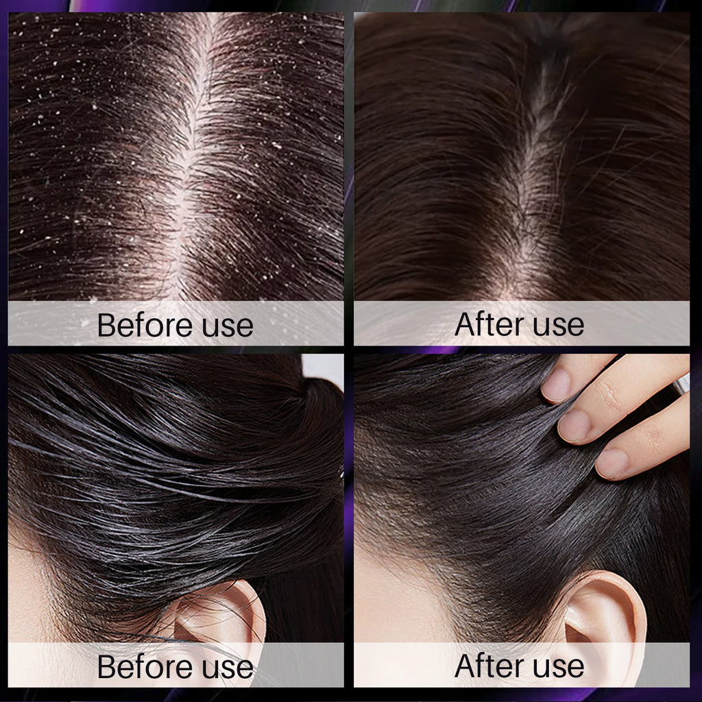 Onion Strengthening Treatment™ Champú para el crecimiento del cabello