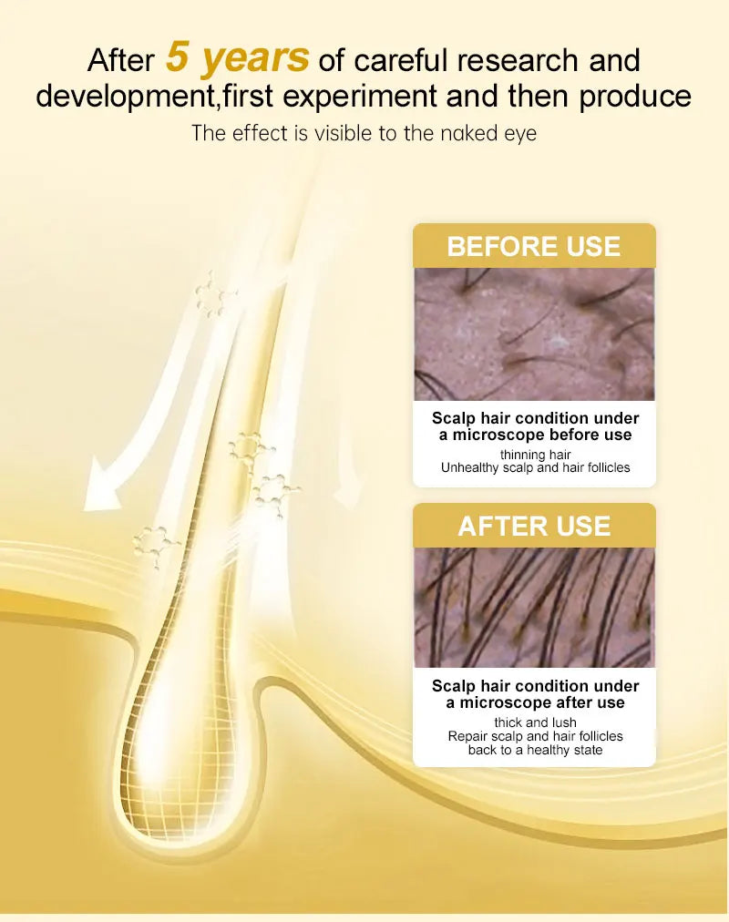 Golden Serum™ - Suero para el crecimiento del cabello