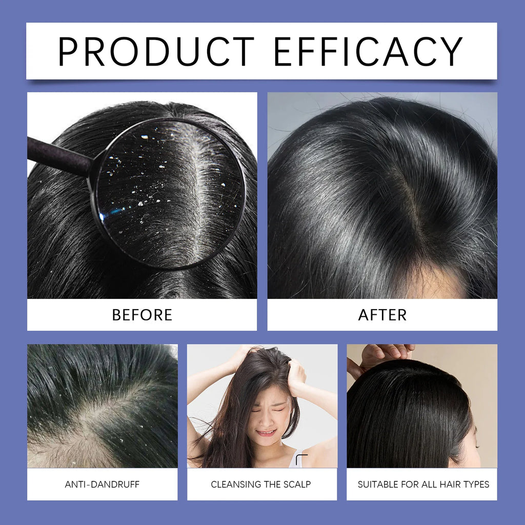 Scalp Relief™ Champú  calmante con sulfuro de selenio