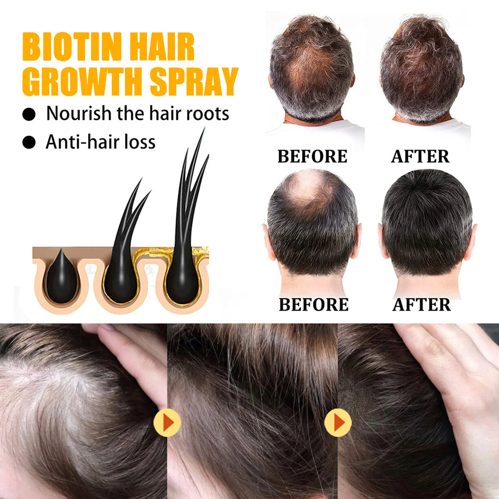Keratin Silk Spray™ Spray de biotina para el cabello